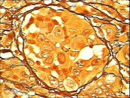 網(wǎng)狀纖維染色