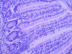 過碘酸—雪夫染色