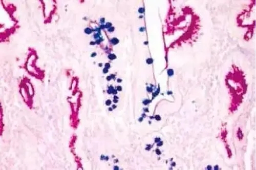 阿辛藍(lán)染色